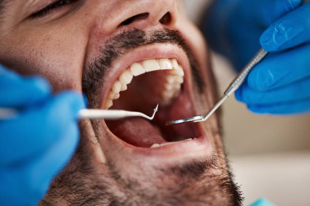 Best Walk-In Emergency Dentist in Mount Pulaski, IL